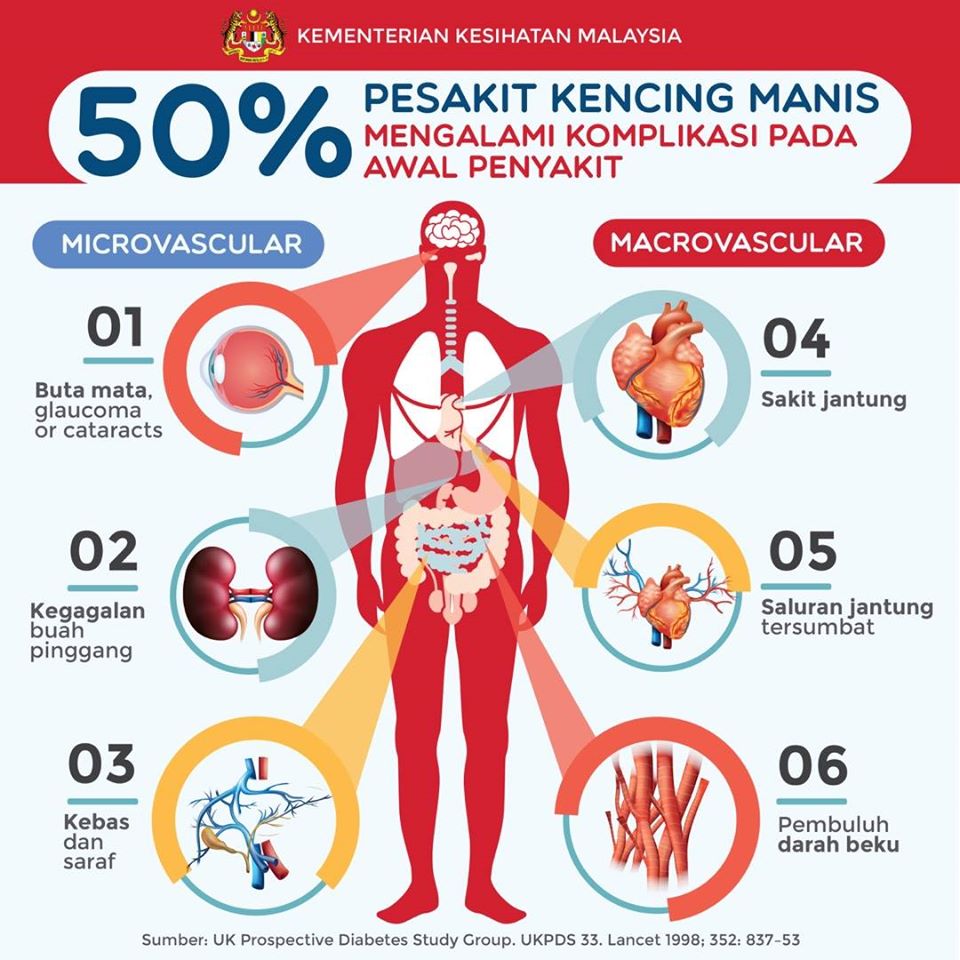 tanda-kencing-manis
