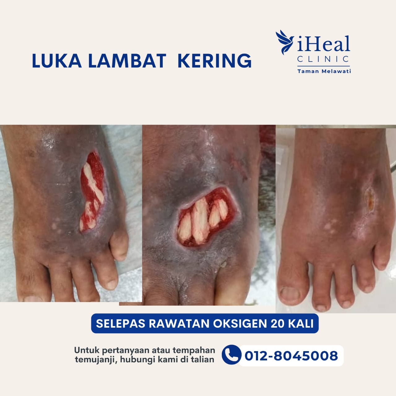 klinik-cuci-luka-oxygen-therapy